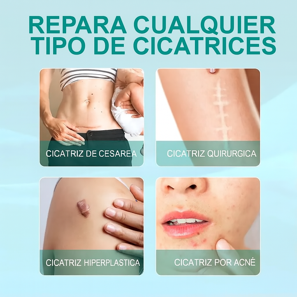 South Moon / Spray Renovador Anti Cicatrices